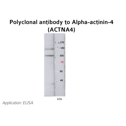 Alpha-actinin-4 (ACTN4) antibody