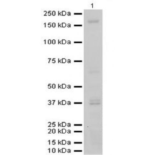 Von Willebrand factor-cleaving protease homolog (ADAM-TS 13) antibody