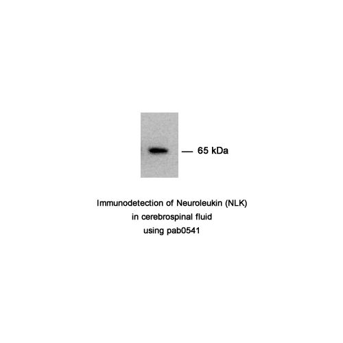 Glucose-6-phosphate isomerase (GPI) antibody