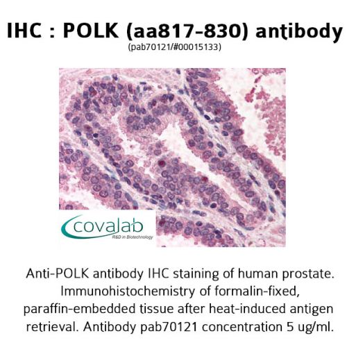 POLK (aa817-830) antibody