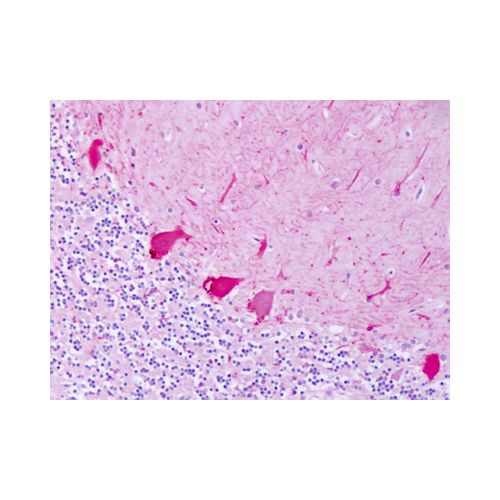 ADRB2 (N-Terminus) antibody