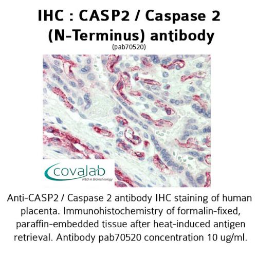 CASP2 / Caspase 2 (N-Terminus) antibody