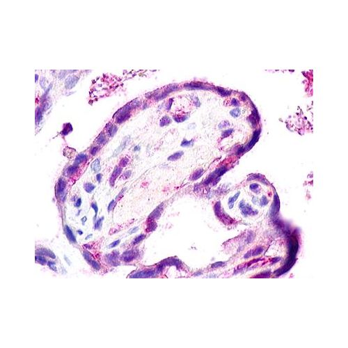 CCBP2 / D6 (Internal) antibody