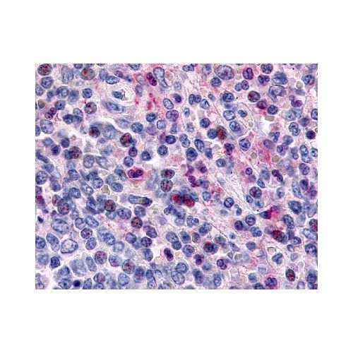 CCR1 (Extracellular Domain) antibody