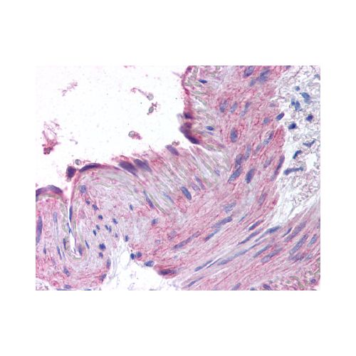 CCR1 (N-Terminus) antibody