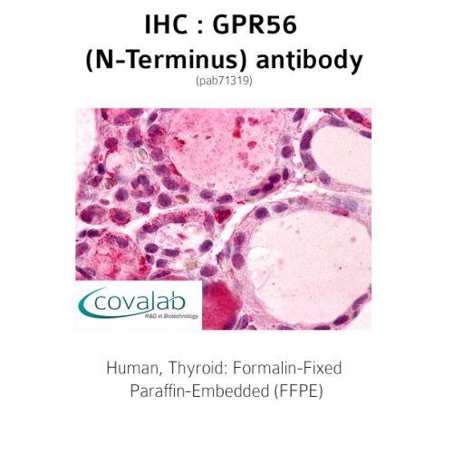 GPR56 (N-Terminus) antibody