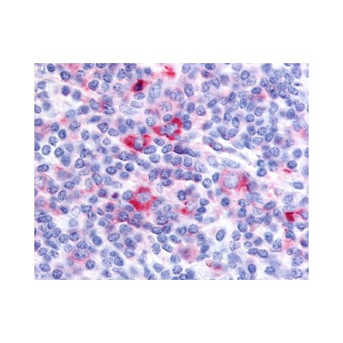 GPRC5D (Cytoplasmic Domain) antibody