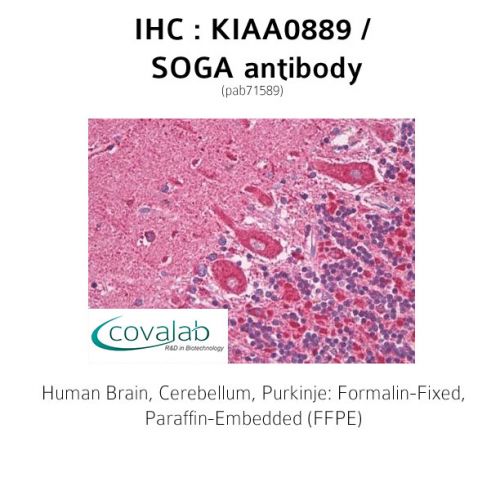 KIAA0889 / SOGA antibody