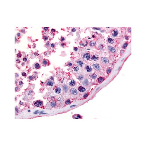 MC5 Receptor (Extracellular Domain) antibody