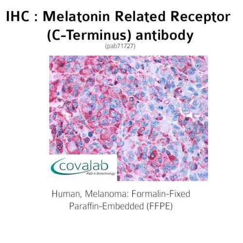 Melatonin Related Receptor (C-Terminus) antibody