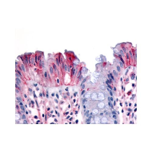 MST1R / RON (Internal) antibody