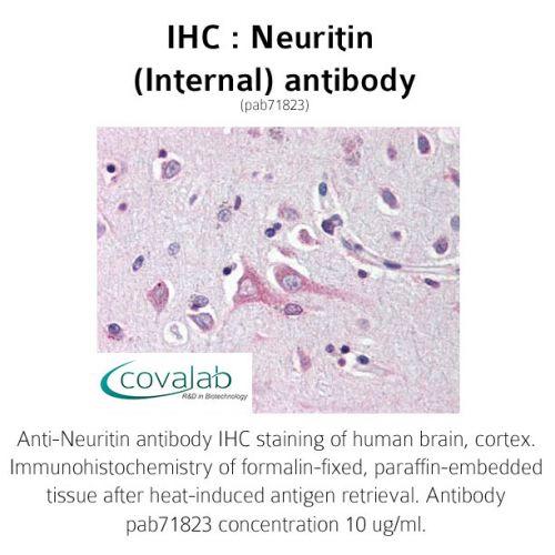 IHC : Neuritin (Internal) antibody<br/>(pab71823)<br/>Anti-Neuritin antibody IHC of human brain, cortex. Immunohistochemistry of formalin-fixed, paraffin-embedded tissue after heat-induced antigen retrieval. Antibody concentration 10 µg/ml.