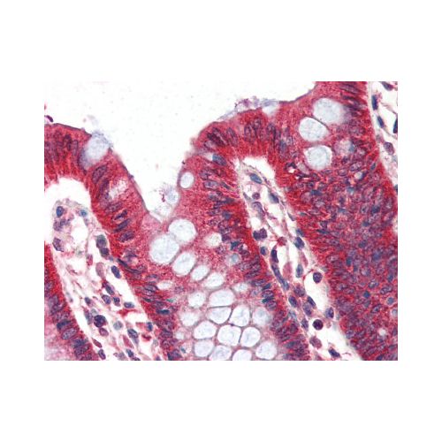 Perilipin (Internal) antibody