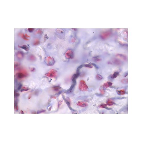 PTH1R / PTHR1 (Internal) antibody