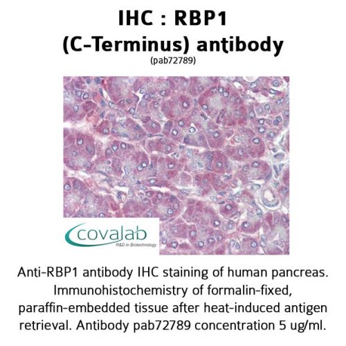 RBP1 (C-Terminus) antibody