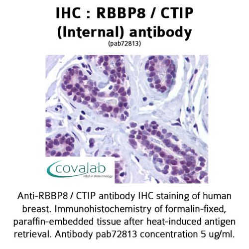 RBBP8 / CTIP (Internal) antibody