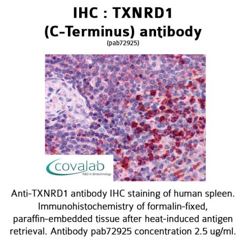 TXNRD1 (C-Terminus) antibody