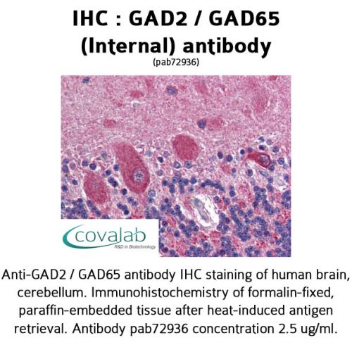 GAD2 / GAD65 (Internal) antibody