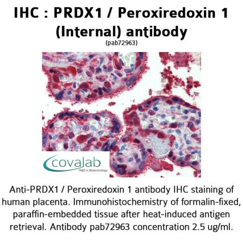 PRDX1 / Peroxiredoxin 1 (Internal) antibody