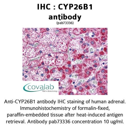 CYP26B1 antibody