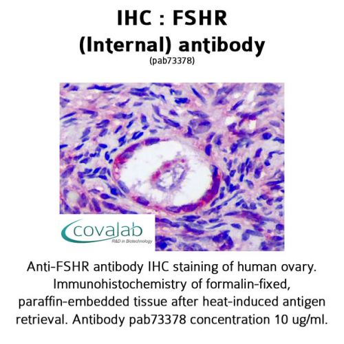 FSHR (Internal) antibody