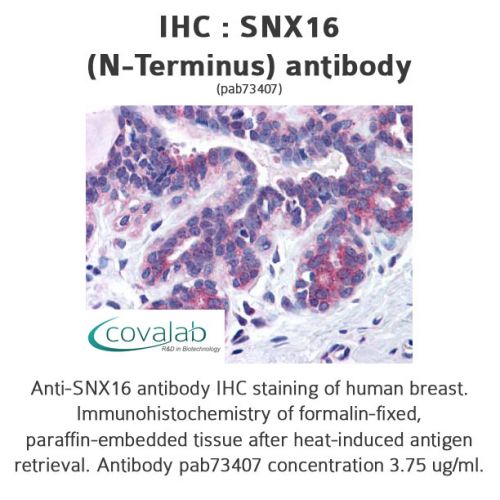 SNX16 (N-Terminus) antibody