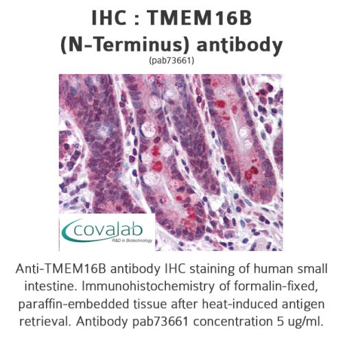 TMEM16B (N-Terminus) antibody