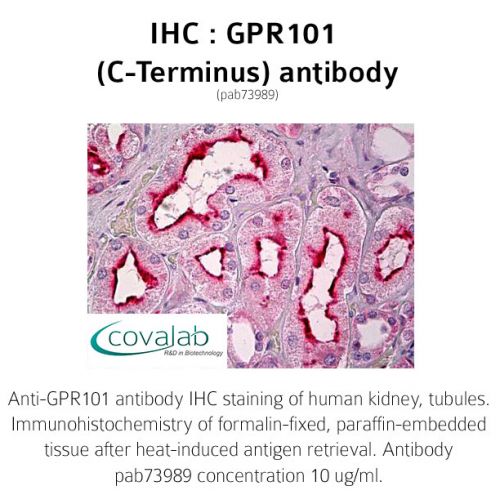 GPR101 (C-Terminus) antibody