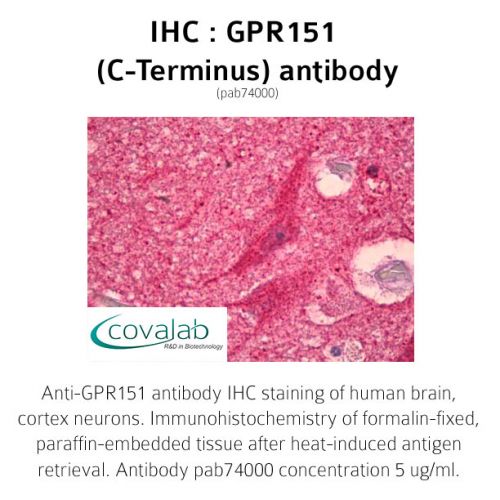 GPR151 (C-Terminus) antibody