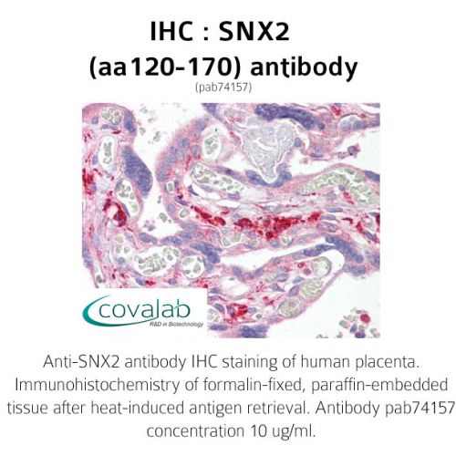 SNX2 (aa120-170) antibody