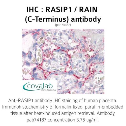 RASIP1 / RAIN (C-Terminus) antibody