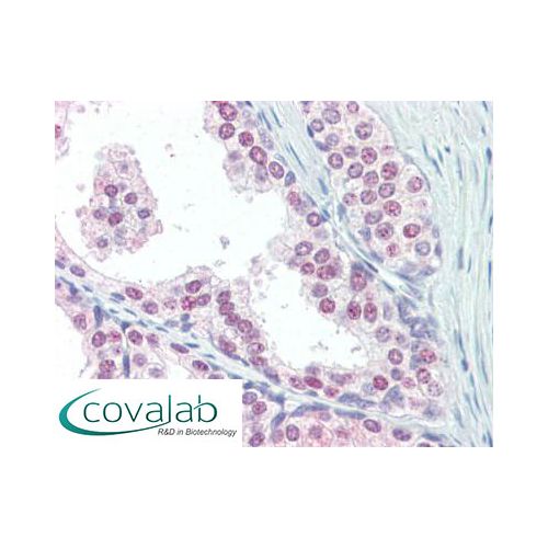 UBC / Ubiquitin C (C-Terminus) antibody