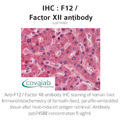 F12 / Factor XII antibody