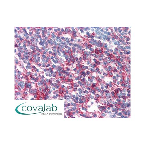 FAS / CD95 (LT95) antibody