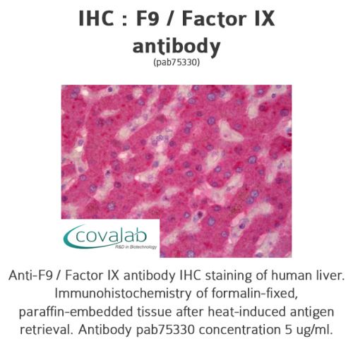 F9 / Factor IX antibody