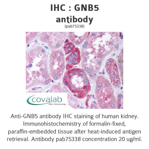 GNB5 antibody