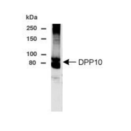 Inactive dipeptidyl peptidase 10 antibody