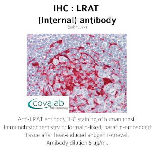 LRAT (Internal) antibody