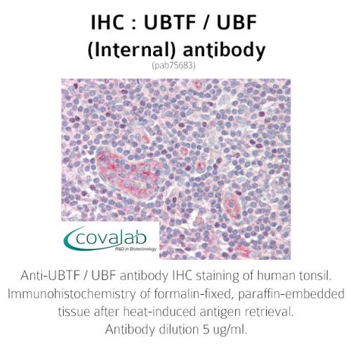 UBTF / UBF (Internal) antibody