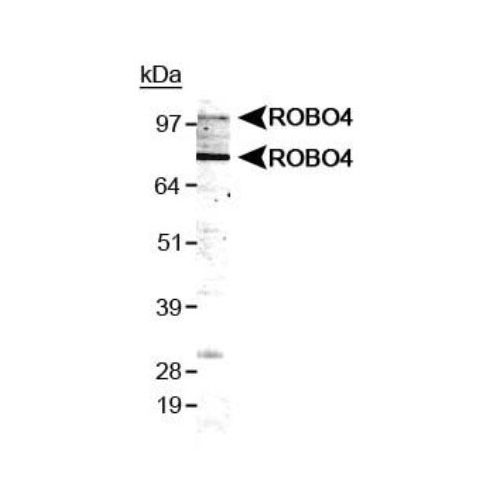 Robo4 antibody