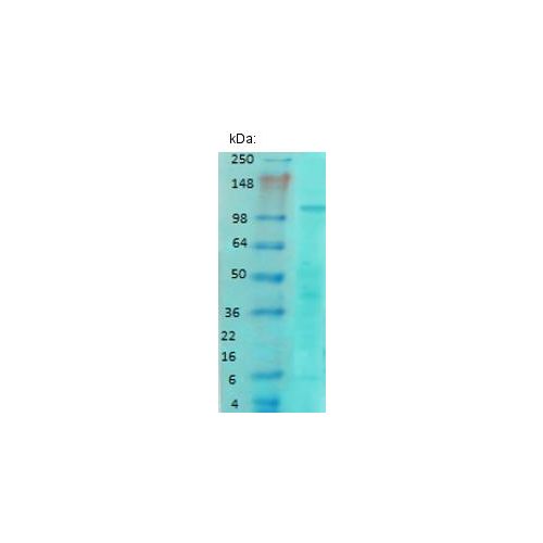 NR1 Glutamate Receptor (S308-48) antibody