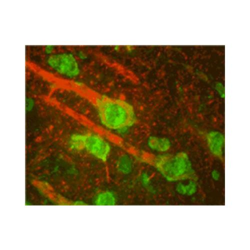 Beta-adrenergic receptor kinase 1 (Beta-ARK-1) antibody