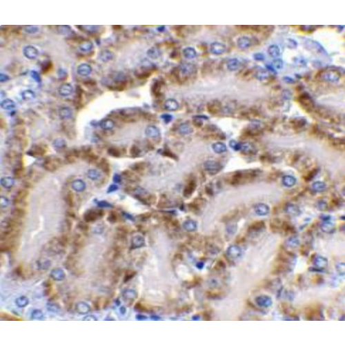 CAD antibody