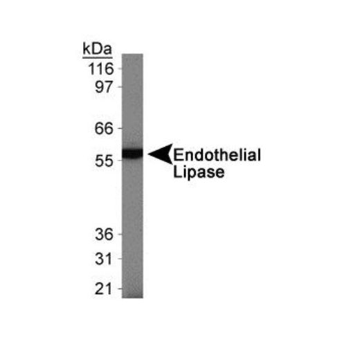 Endothelial lipase antibody