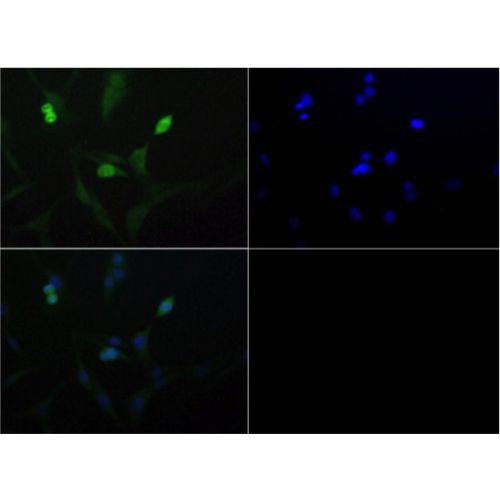 Ragulator complex protein LAMTOR2 antibody