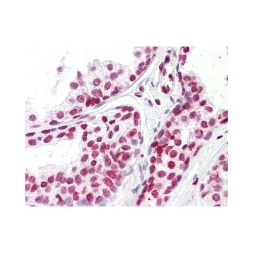 IHC : FOXH1 (N-Terminus) antibody<br/>(pab75936)<br/>Human Prostate: Formalin-Fixed, Paraffin-Embedded (FFPE)