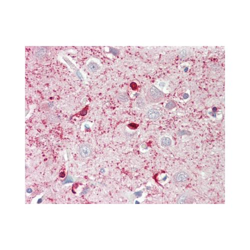 MED24 / TRAP100 (aa801-850) antibody