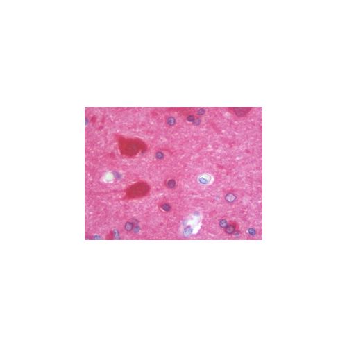 MAPRE2 / EB2 antibody (1F3)