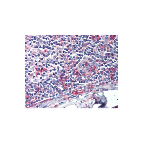 FCGR1A antibody (3D3)