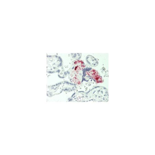 MGP antibody (11G8)